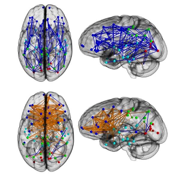 brain connectivity