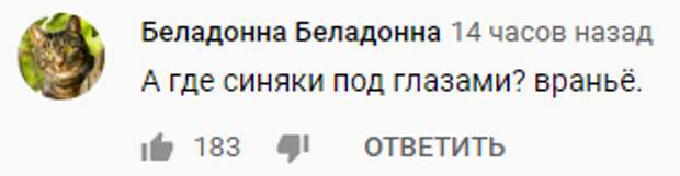 Телезрители заподозрили Собчак в пластике носа под сомнительным предлогом