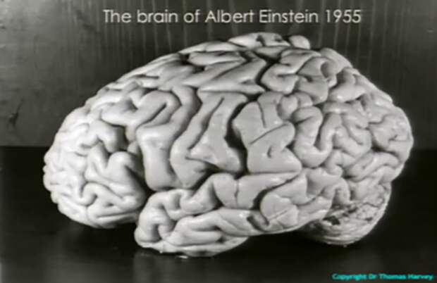Одна из фотографий мозга Эйнштейна.