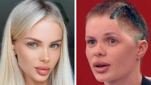 «Для меня это просто удар»: избитая до полусмерти модель Анжелика Тартанова впервые рассказала о роковой ночи