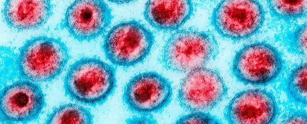 Американка полностью излечилась от ВИЧ после уникального медицинского лечения