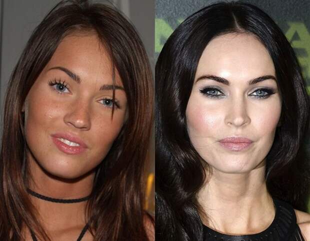 Знаменитости и их обновлённые лица