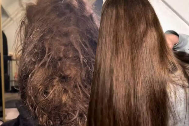 В Нидерландах парикмахер 32 часа распутывала волосы клиентки, лежавшей в коме