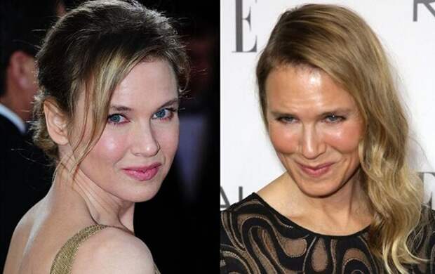 Знаменитости и их обновлённые лица