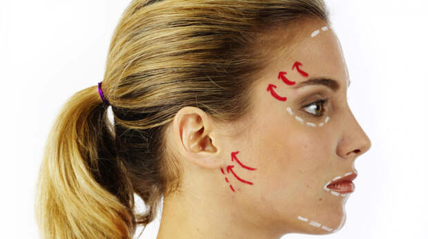 Омоложение от «кутюр»: как работает глубокая подтяжка Deep Plane Facelift