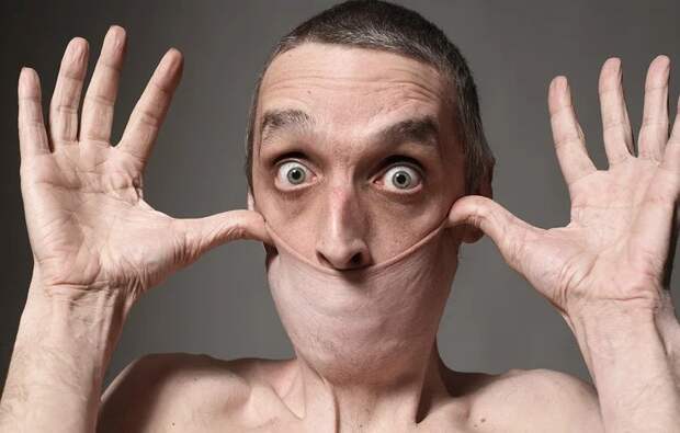 Резиновое лицо: как живет Гарри Тёрнер, человек с самой эластичной кожей в мире