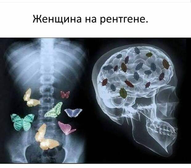 Как снять Боль за 15 минут! Практика и Таблица причин