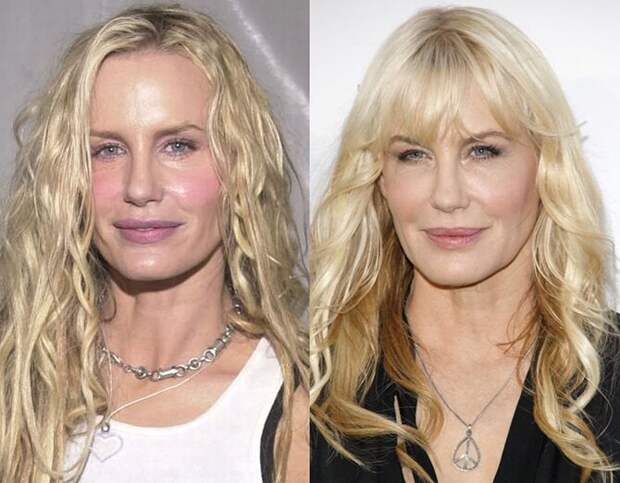 Знаменитости и их обновлённые лица