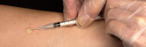 Можно ли победить туберкулез, рассказала врач из Алматы