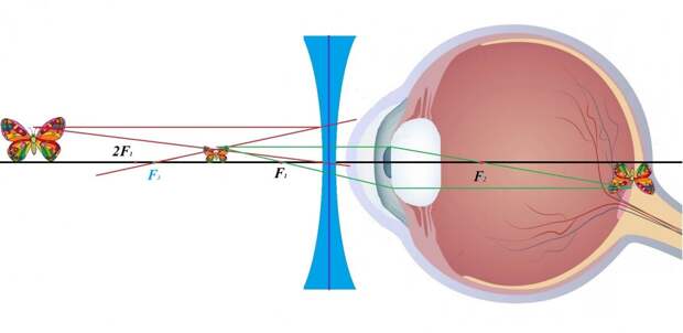 Как очки убивают наше зрение. Естественное восстановление зрения - метод Шичко-Бейтса