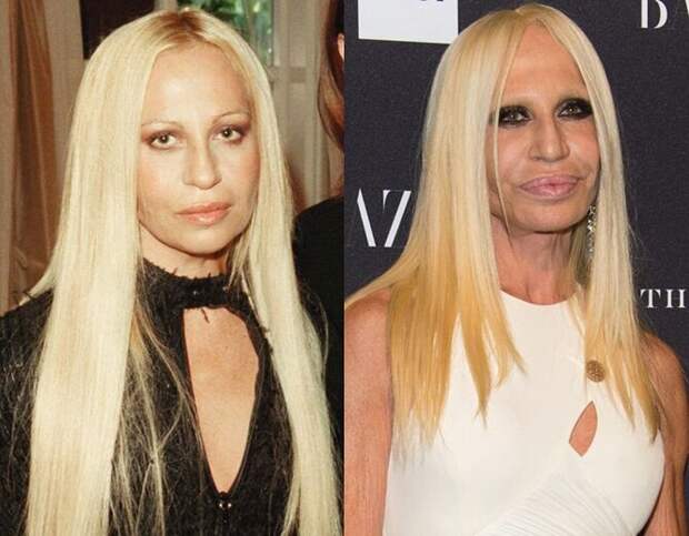 Знаменитости и их обновлённые лица