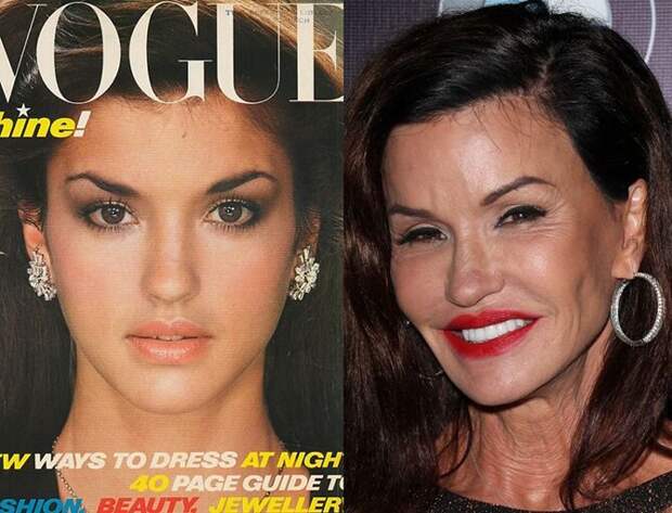 Знаменитости и их обновлённые лица