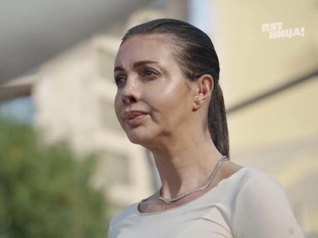 Аршавина восстановила хронологию потери носа: «Увидела черную смолу»