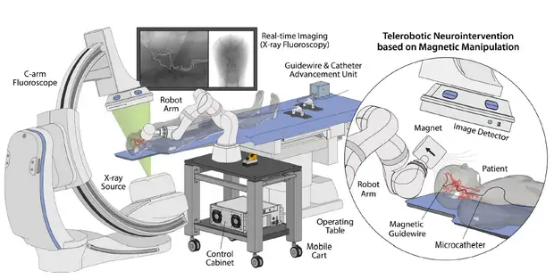 Роборуку с магнитом приспособили для удаленных эндоваскулярных операций