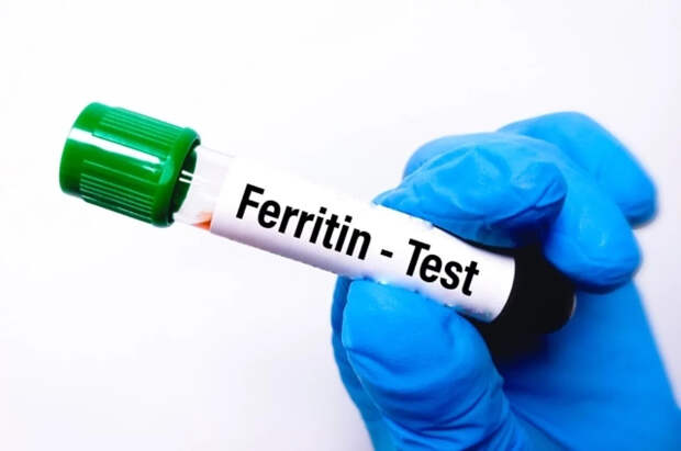 Доктор Мясников рассказал, о чем говорит повышенный ферритин