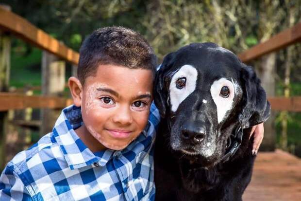 Мальчик с редким заболеванием кожи ненавидел свой внешний вид, пока не встретил такую же собаку животные, собака