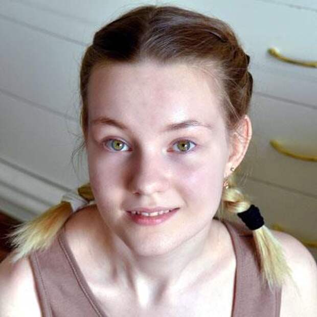 Лиза Будкина, 16 лет, грудопоясничный сколиоз 4-й степени, спасет операция, 992 825 ₽