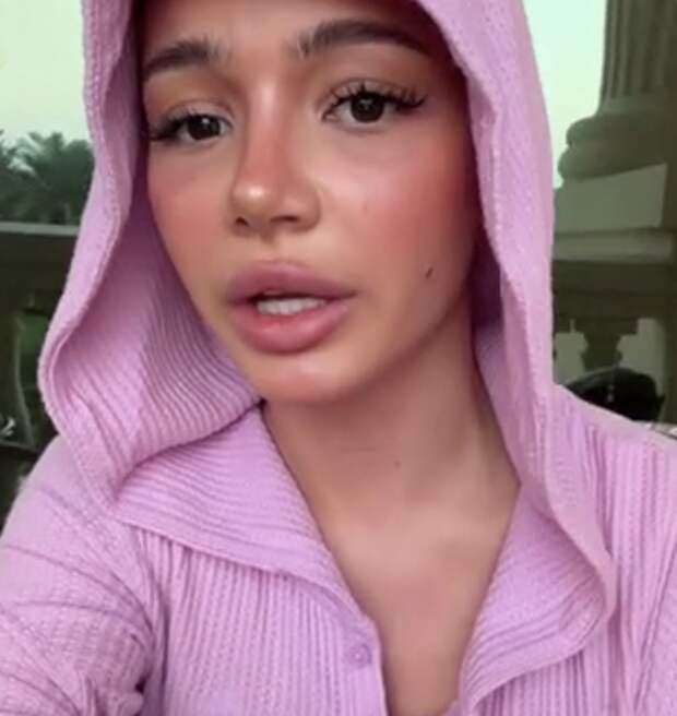 Певица Карнавал призналась, что расплакалась из-за обвинений в неестественности