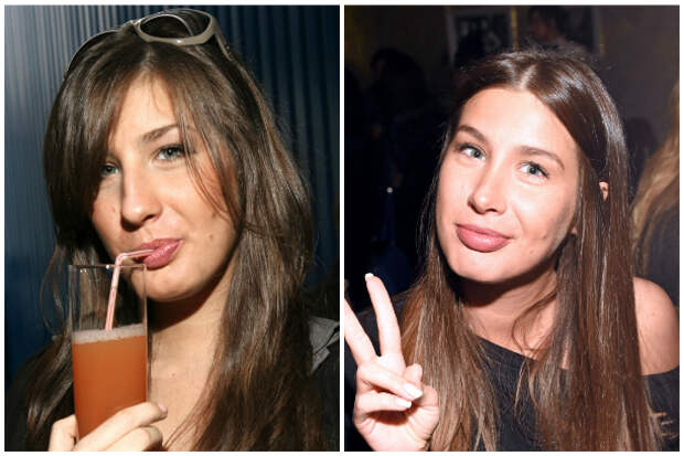 Кэти Топурия пластика фото до и после