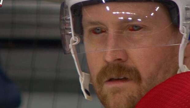 Jeff Petry bloody eyes broken finger