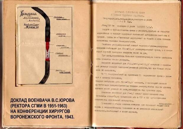«Ампутация проведена под крикоином». Медицина в Сталинградской битве