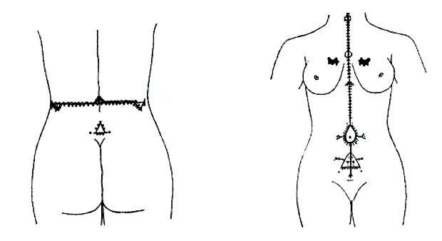 Cхема татуировок на теле у арабских женщин. 1930 г.