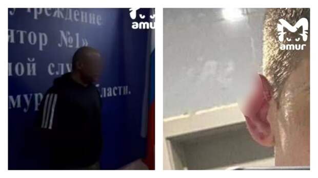 Иностранец откусил ухо парню и лишился гражданства РФ / Фото: Amur Mash