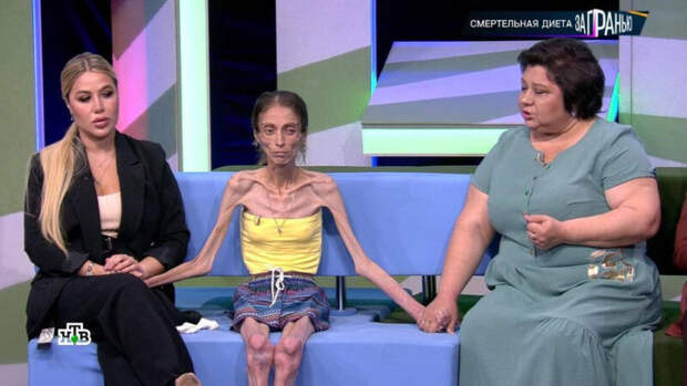 «Пухлые щёчки» ценой в жизнь: как роковая фраза мужа довела Яну Боброву до 20 кг и что спасло её