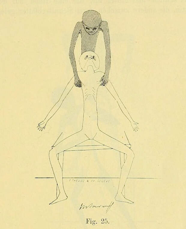 lechebnaya-gimnastika-v-ginekologii-po-Ture-Brandtu-illyustratsii 9