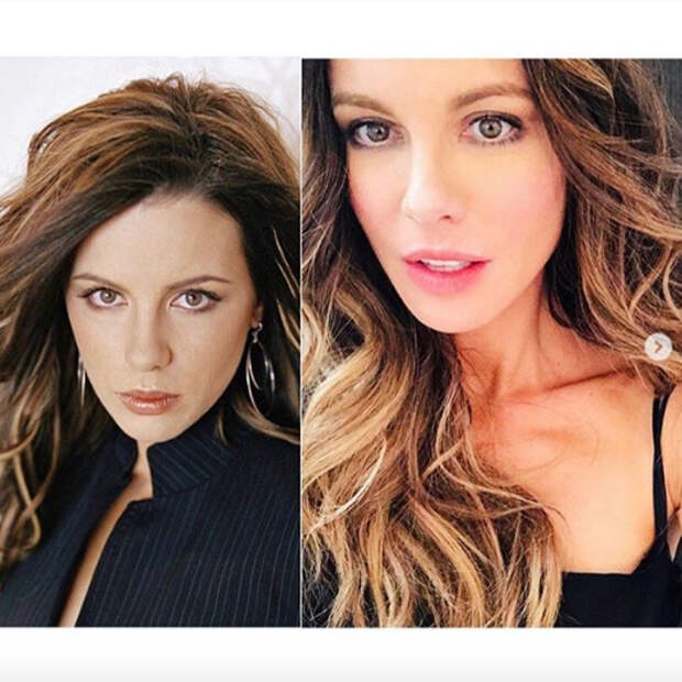 Кейт Бекинсейл в #100YearChallenge