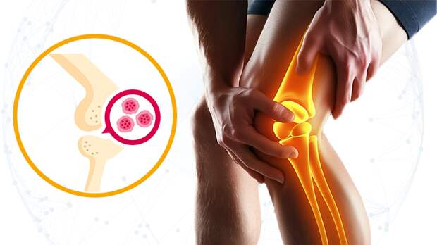 Прорыв в лечении артрита: "Укол от старости" заставил хрящ в колене расти заново