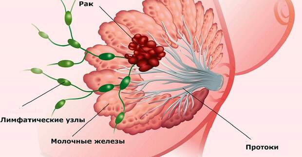 боль в области груди у женщин