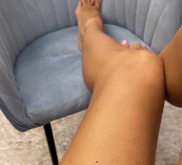 Певица Анна Седокова пожаловалась на самочувствие из-за вернувшейся крапивницы