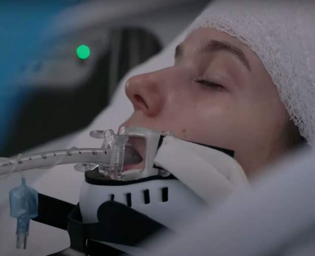 Closeup of a woman on life support with a breathing tube and bandage on her head on Law & Order: SVU Season 26 Episode 6