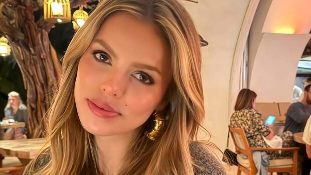 Популярная модель показала внешность после удаления филлеров из губ