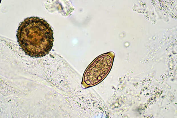 Яйца аскариды и власоглава под микроскопом