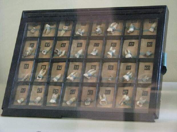 Зубы удаленные Петром I. Хранятся в кунсткамере. Всего 73 шт.