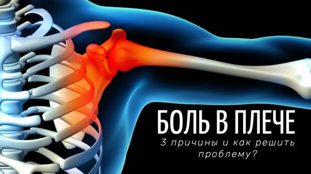 Боль в плече: 3 наиболее распространенных причины и как решить проблему