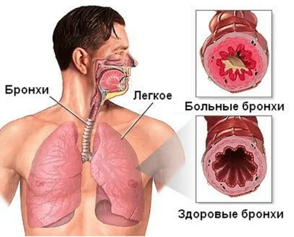 Фото бронхи человека