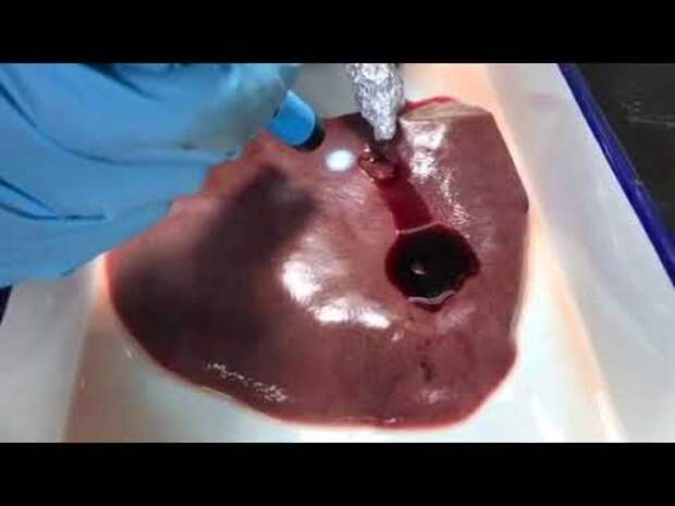 Создан гидрогель, способный остановить артериальное кровотечение