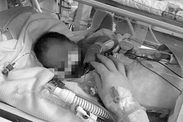 В Британии женщина потеряла ребенка, потому что врачи не стали ее будить