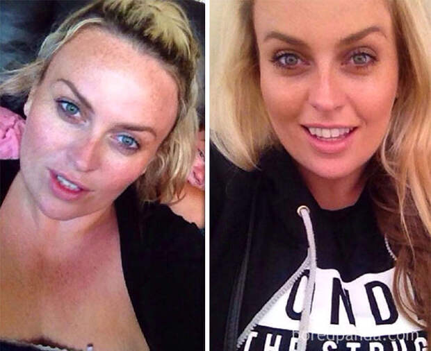 before-after-sobriety-photos-69