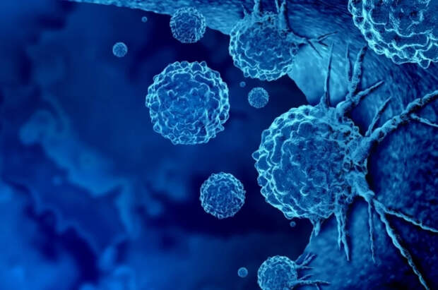 Онколог Ивашков раскрыл связь между пессимизмом и раком