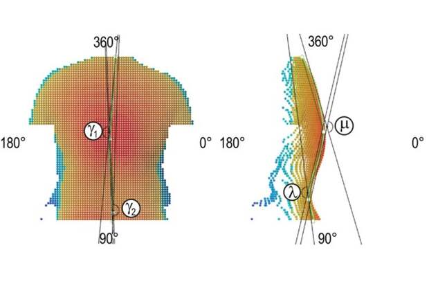 Образцы трехмерных изображений дорсальной (со стороны спины) поверхности тела человека, получаемых с помощью ScolView™. Зеленым обозначена кривая N0O (соответствующая линии позвоночника); а, б — вид в фронтальной и сагиттальной плоскости (т.е. вид сзади и сбоку), символами указаны углы деформации линии позвоночника. Источник изображения: И.Д. Шитоев (автор) / предоставлено пресс-службой ПНИПУ