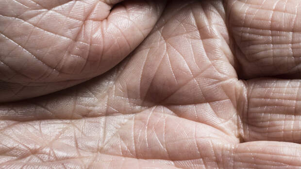 Дерматолог Котова объяснила, как распознать и вылечить обезвоженную кожу