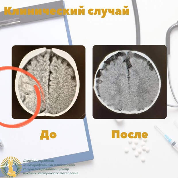 Маленький петербуржец вернулся к родителям после падения с кровати