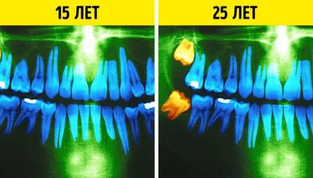 26 неизбежных изменений в организме, которые мы можем наблюдать каждые 10 лет