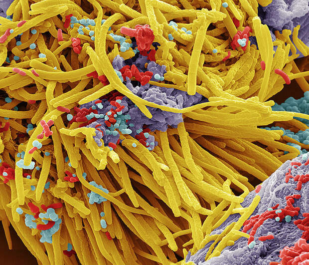 Фото №5 - Управляющая компания: как бактерии руководят людьми