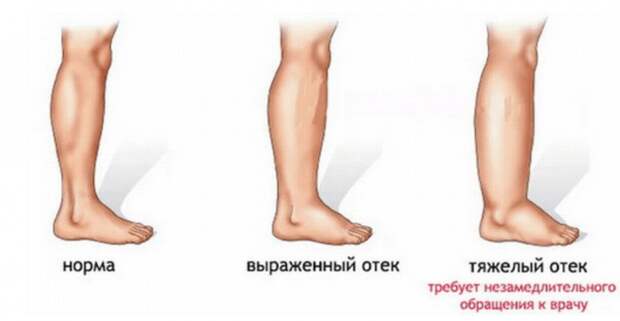 original (3)
