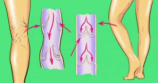 thumb-600x315 (2)